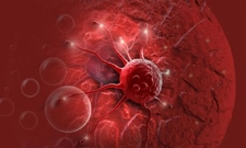 Prolaktin Yüksekliği Nedenleri?